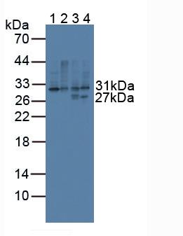 Polyclonal Antibody to Cluster Of Differentiation 74 (CD74)