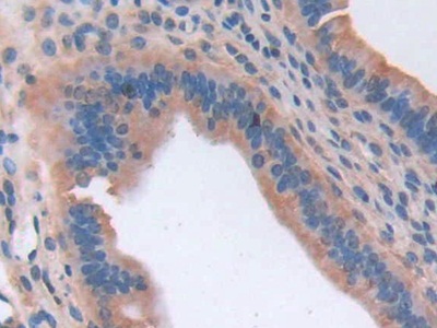 Polyclonal Antibody to Cluster Of Differentiation 74 (CD74)