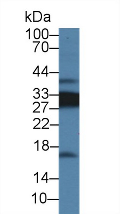 Polyclonal Antibody to Cluster Of Differentiation 74 (CD74)