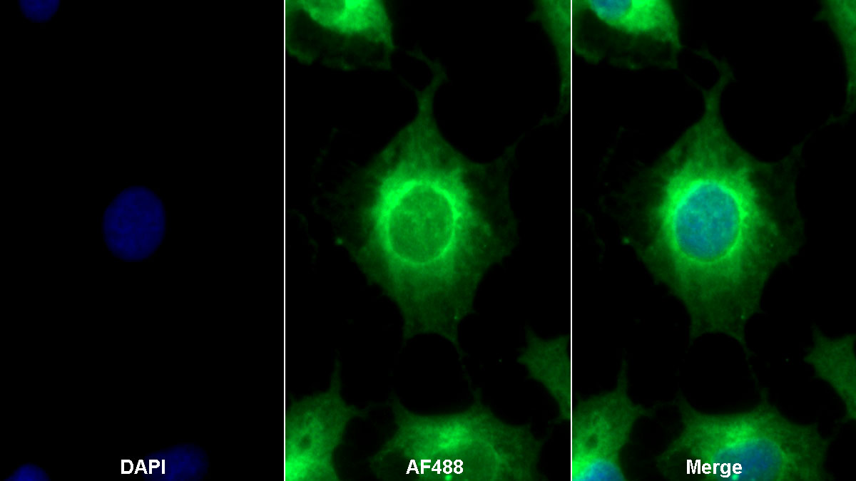 Polyclonal Antibody to Lactate Dehydrogenase A (LDHA)