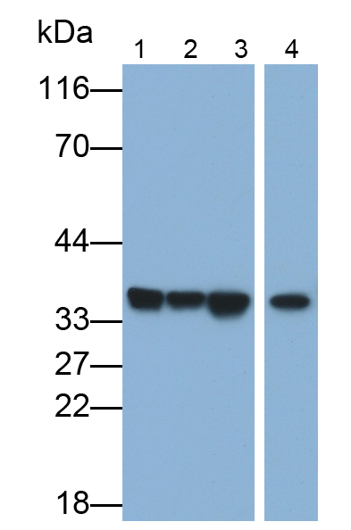 Polyclonal Antibody to Lactate Dehydrogenase A (LDHA)