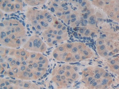 Polyclonal Antibody to Defensin Beta 1 (DEFb1)