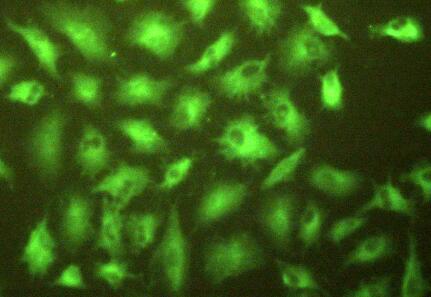 Polyclonal Antibody to Gamma-Glutamyltransferase 1 (gGT1)