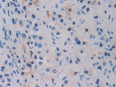 Polyclonal Antibody to Breast Cancer Susceptibility Protein 1 (BRCA1)