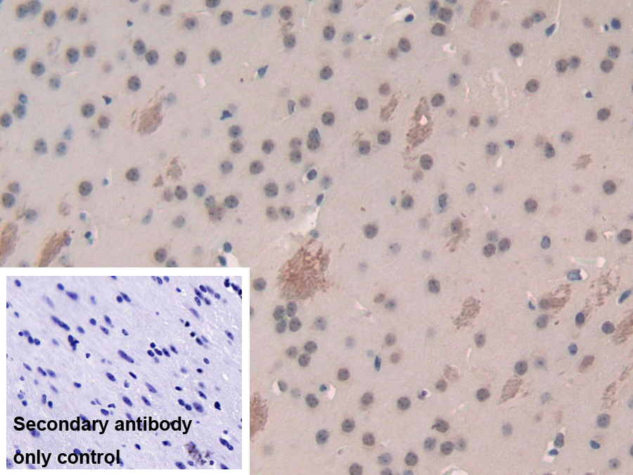 Polyclonal Antibody to Breast Cancer Susceptibility Protein 1 (BRCA1)