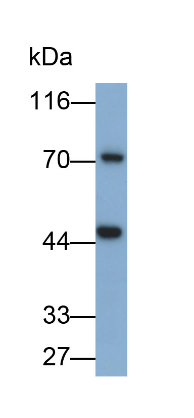 Polyclonal Antibody to Protein Kinase C Zeta (PKCz)