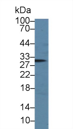 Polyclonal Antibody to Immunoglobulin Associated Alpha (Iga)