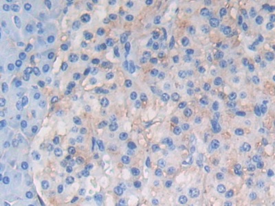 Polyclonal Antibody to Activating Transcription Factor 6 (ATF6)