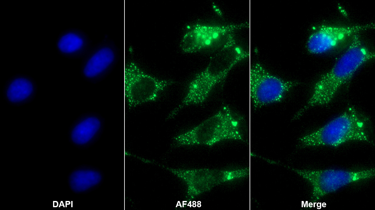 Polyclonal Antibody to Platelet Activating Factor Acetylhydrolase Ib3 (PAFAH1B3)