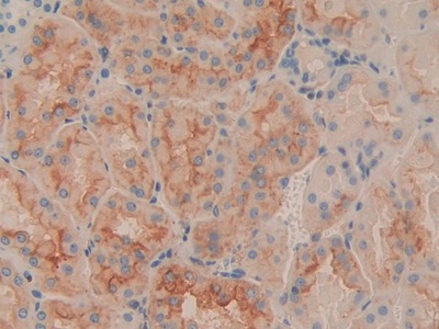 Polyclonal Antibody to Cluster of Differentiation 90 (CD90)