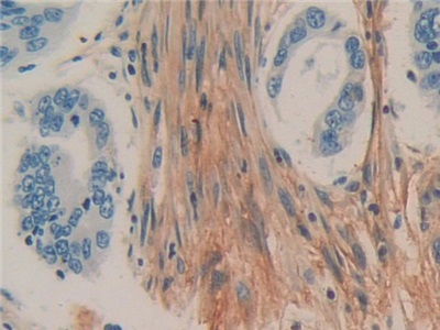 Polyclonal Antibody to Cluster of Differentiation 90 (CD90)