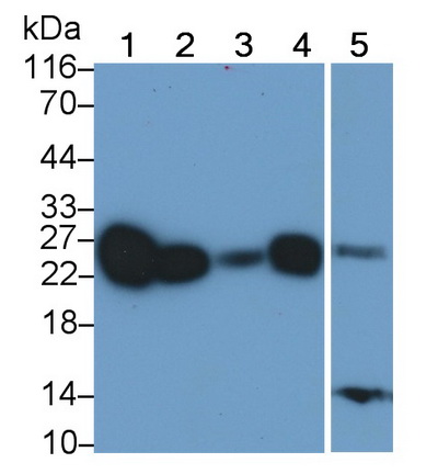 Polyclonal Antibody to Cluster of Differentiation 90 (CD90)