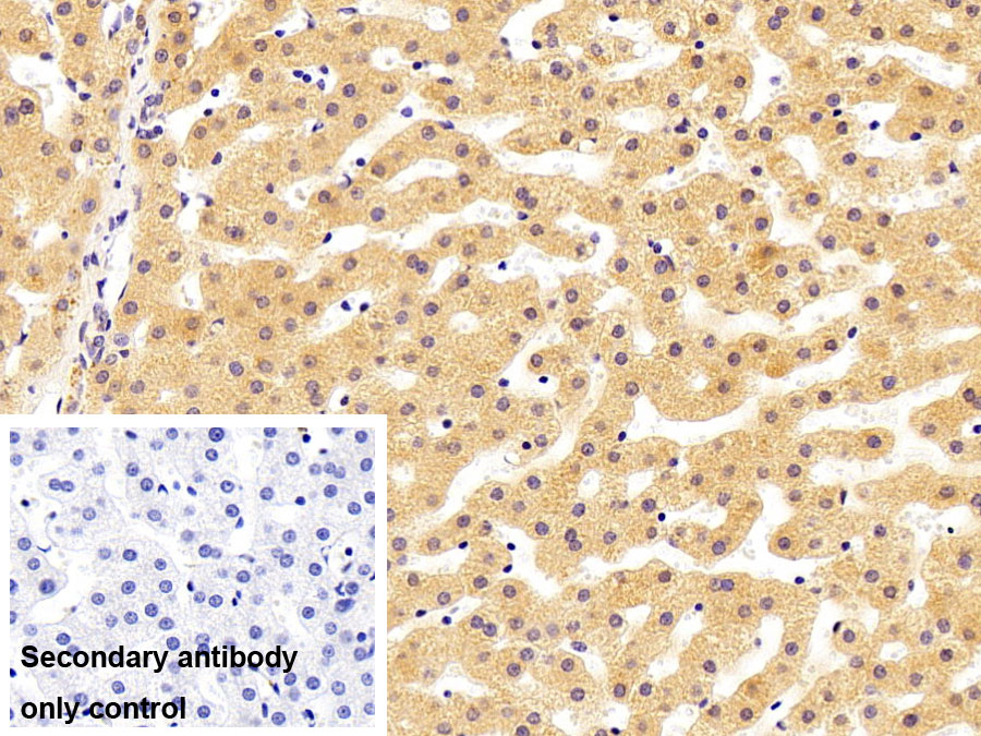 Polyclonal Antibody to Lipopolysaccharide Binding Protein (LBP)