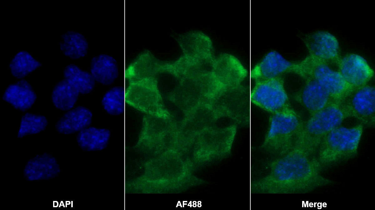 Polyclonal Antibody to Lipopolysaccharide Binding Protein (LBP)