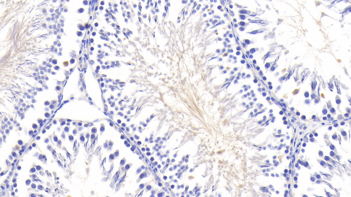 Polyclonal Antibody to Lipopolysaccharide Binding Protein (LBP)