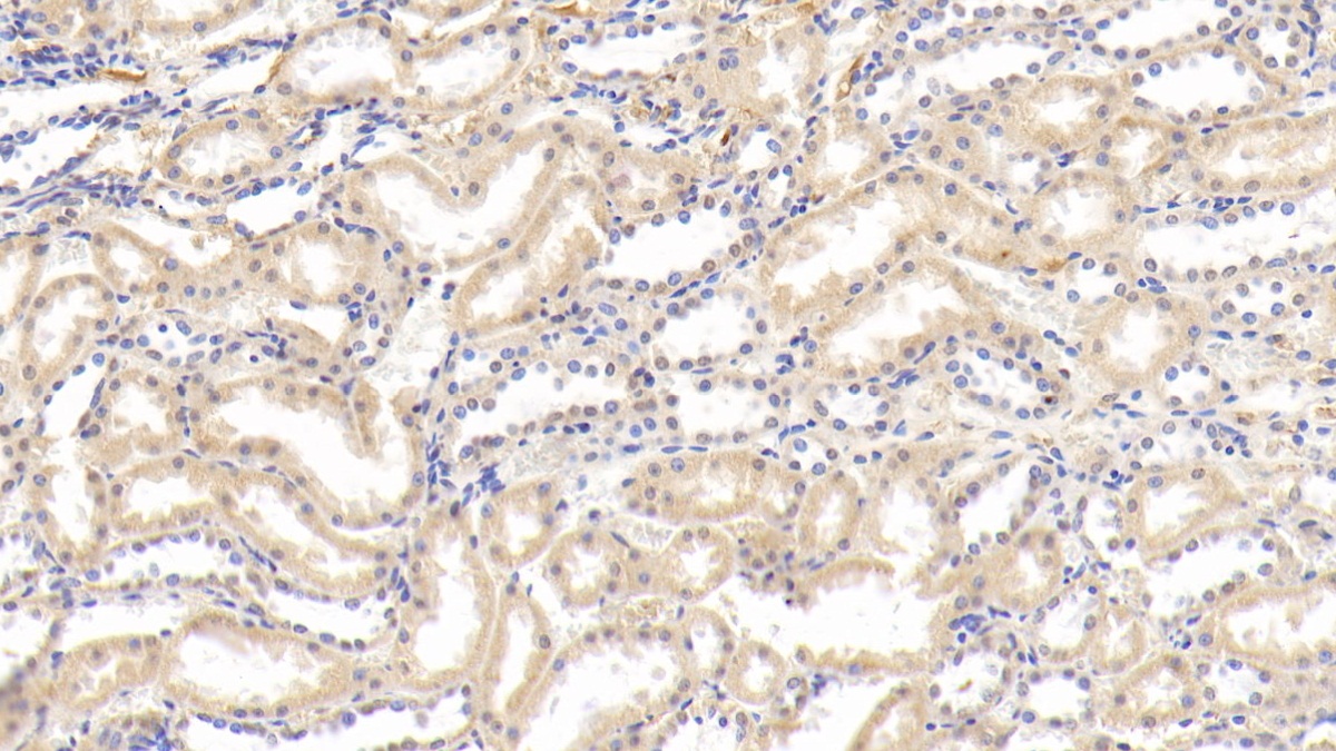 Polyclonal Antibody to Lipopolysaccharide Binding Protein (LBP)