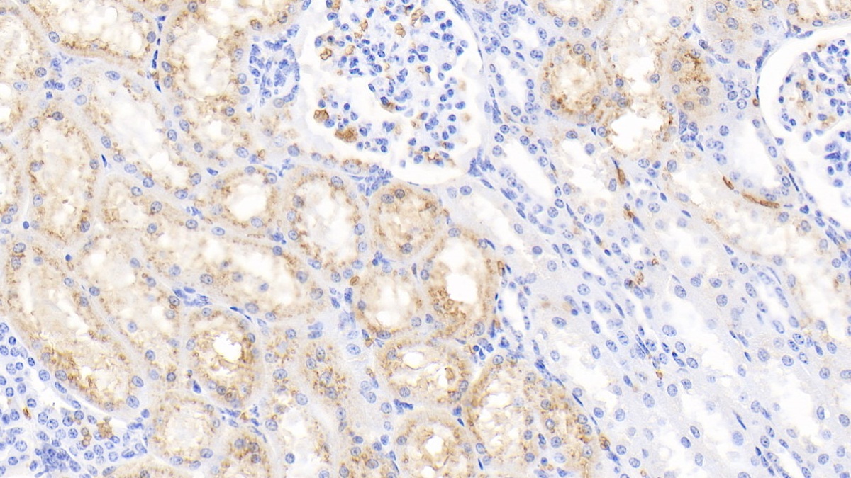 Polyclonal Antibody to Hemoglobin (HB)