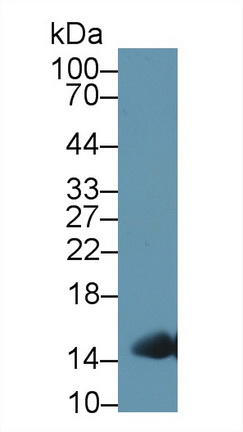 Polyclonal Antibody to Hemoglobin (HB)