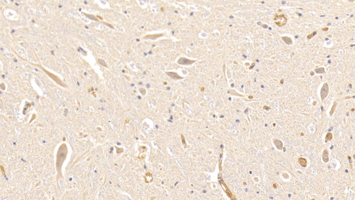 Polyclonal Antibody to Hemoglobin (HB)