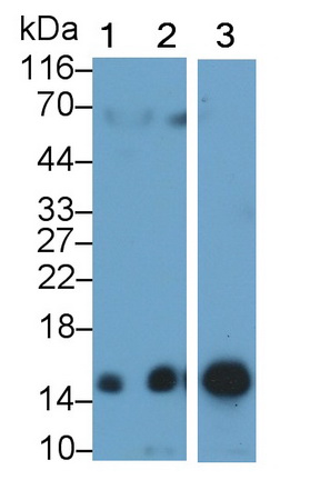 Polyclonal Antibody to Hemoglobin (HB)