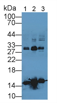 Polyclonal Antibody to Hemoglobin (HB)