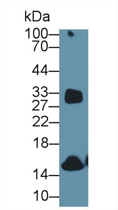 Polyclonal Antibody to Hemoglobin (HB)