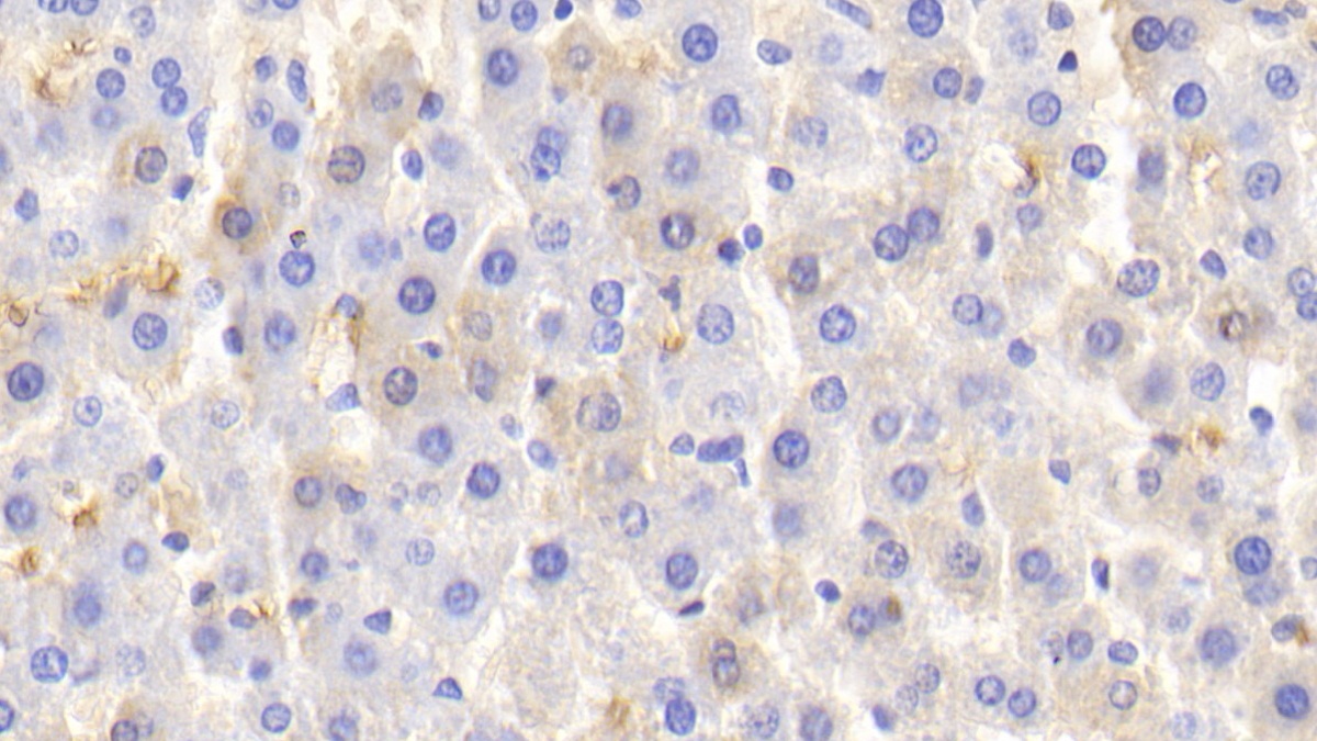 Polyclonal Antibody to Hemoglobin (HB)