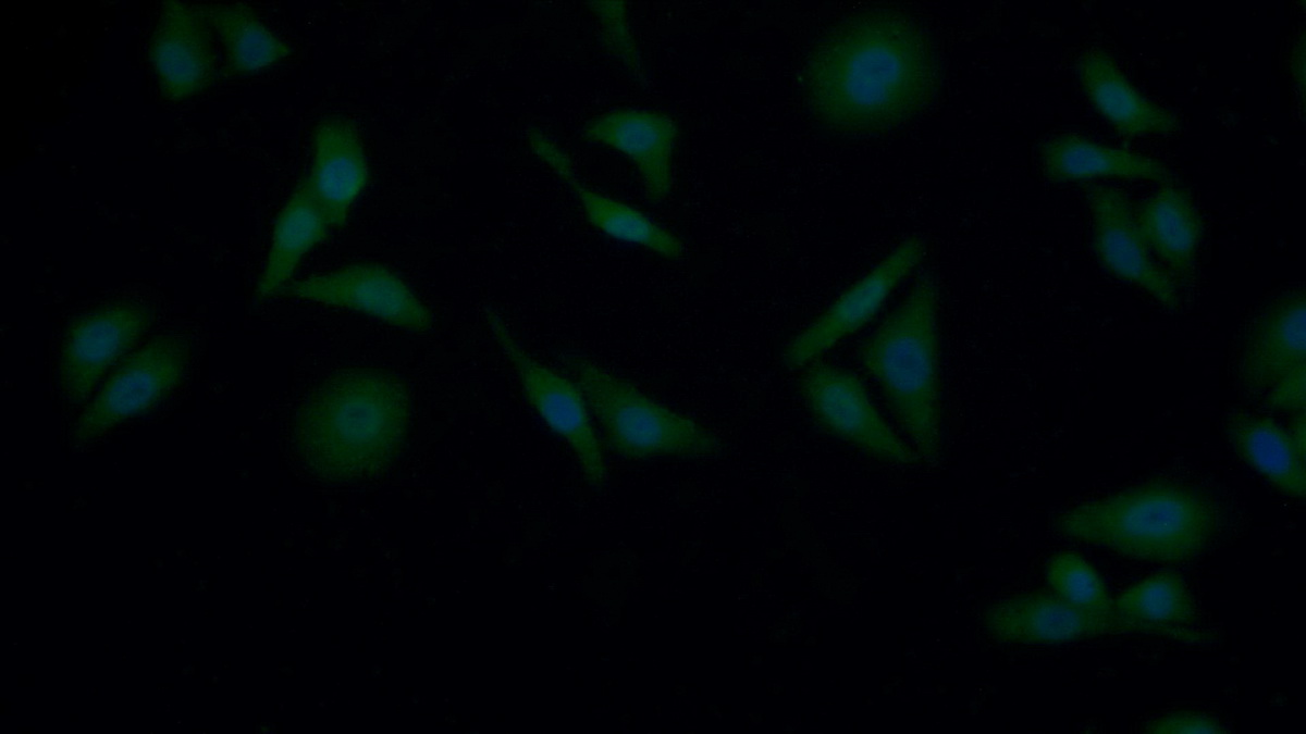 Polyclonal Antibody to Glucuronidase Beta (GUSb)