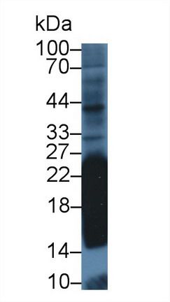 Polyclonal Antibody to Cluster Of Differentiation 99 (CD99)