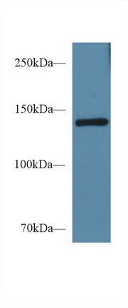 Polyclonal Antibody to Semaphorin 4D (SEMA4D)