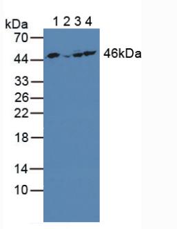 Polyclonal Antibody to Enolase 3 (ENO3)