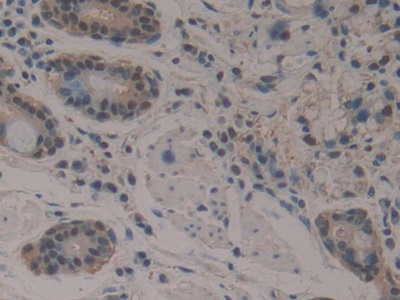 Polyclonal Antibody to Enolase 3 (ENO3)