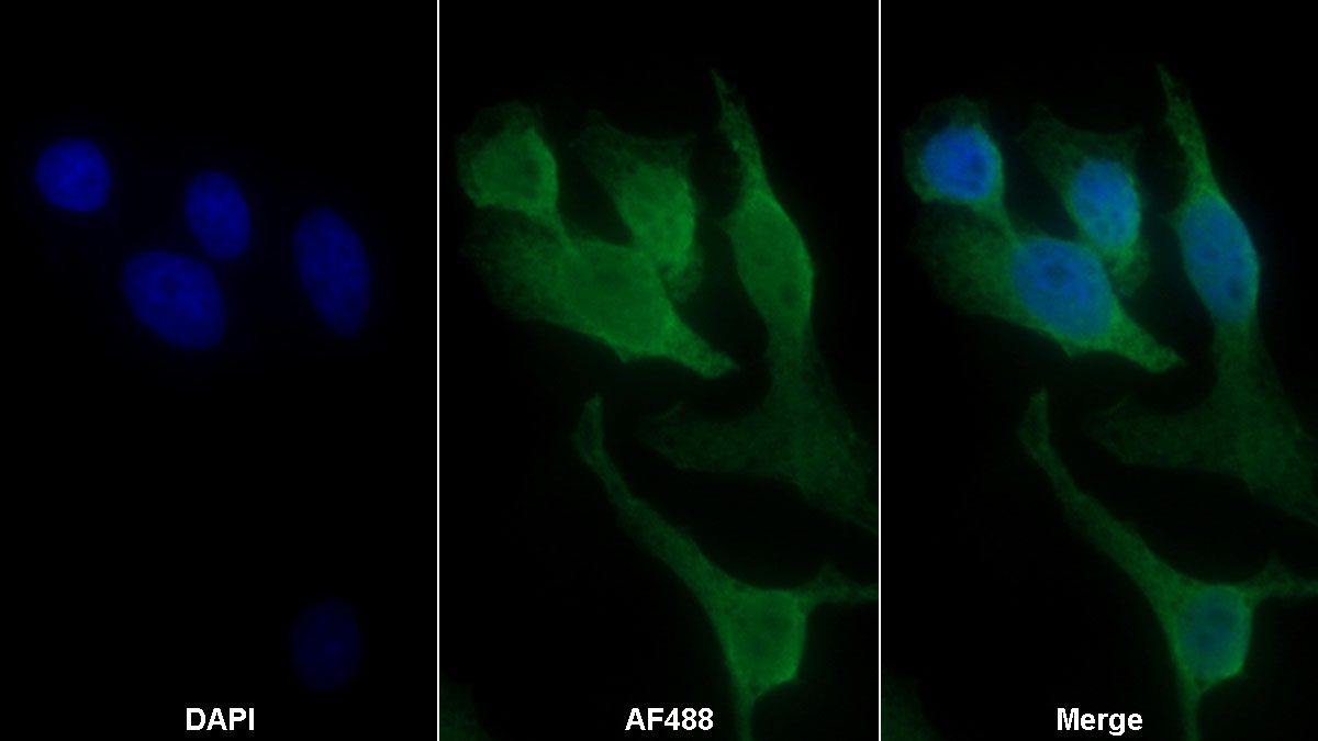 Polyclonal Antibody to Enolase 3 (ENO3)