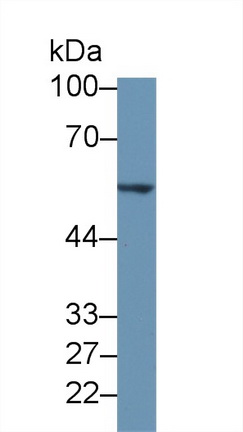 Polyclonal Antibody to Tyrosine Hydroxylase (TH)