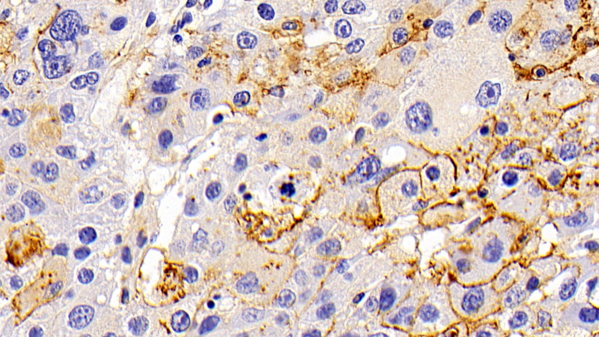 Polyclonal Antibody to Lysosomal Associated Membrane Protein 1 (LAMP1)