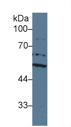 Polyclonal Antibody to Acetylcholinesterase (ACHE)