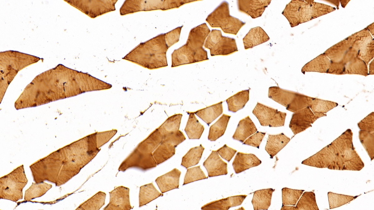 Polyclonal Antibody to Enolase 1 (ENO1)