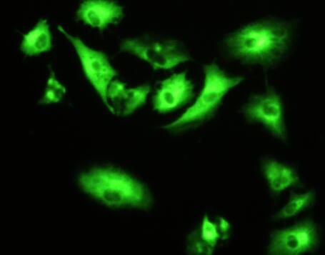 Polyclonal Antibody to Aminopeptidase B (RNPEP)