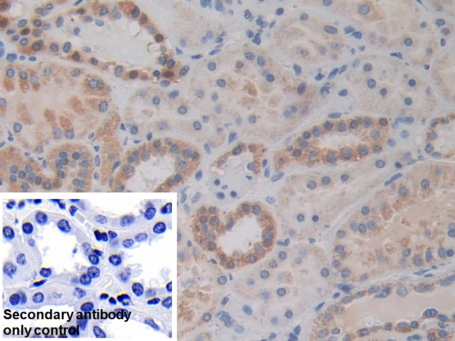 Polyclonal Antibody to MAP Kinase Activated Protein Kinase 2 (MAPKAPK2)