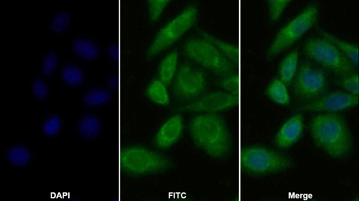 Polyclonal Antibody to Lysosomal Associated Membrane Protein 2 (LAMP2)