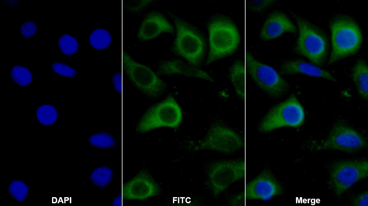 Polyclonal Antibody to Lysosomal Associated Membrane Protein 2 (LAMP2)