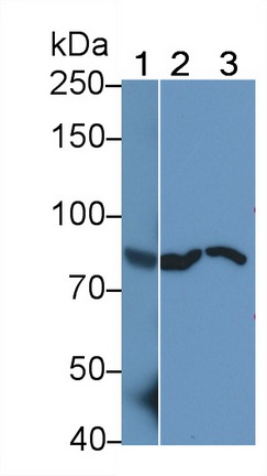 Polyclonal Antibody to Colony Stimulating Factor Receptor, Granulocyte (GCSFR)