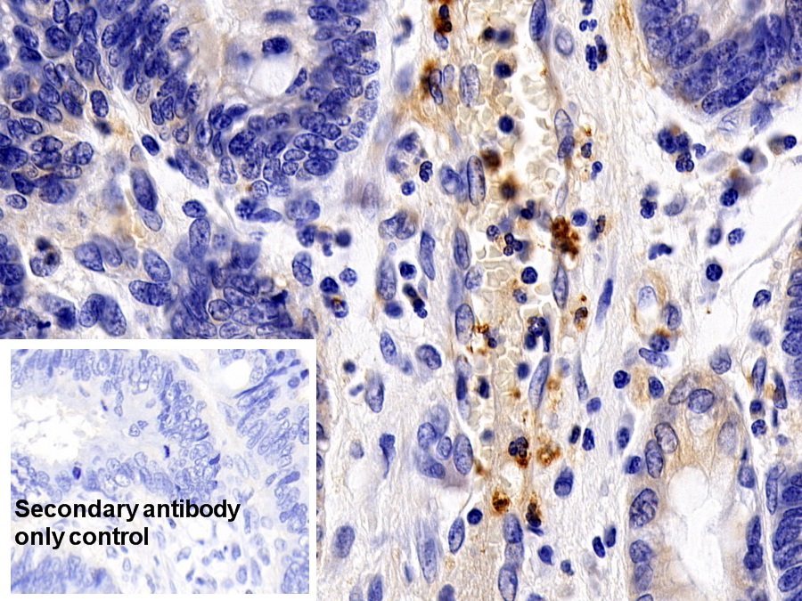 Polyclonal Antibody to Colony Stimulating Factor Receptor, Granulocyte (GCSFR)