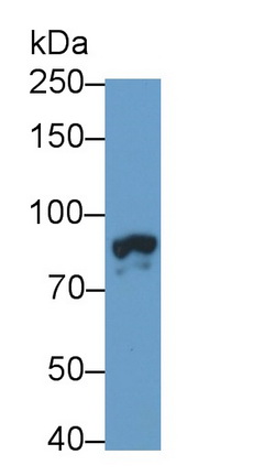 Polyclonal Antibody to Colony Stimulating Factor Receptor, Granulocyte (GCSFR)