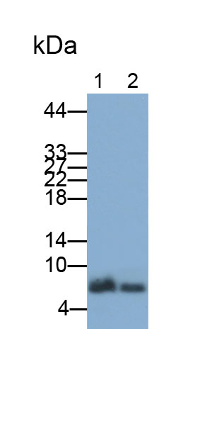 Polyclonal Antibody to Matrix Gla Protein (MGP)