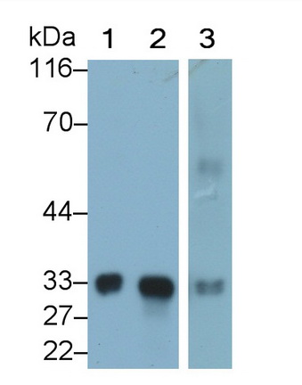 Polyclonal Antibody to Mannose Binding Lectin (MBL)