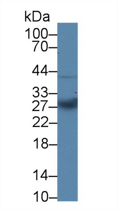 Polyclonal Antibody to Mannose Binding Lectin (MBL)