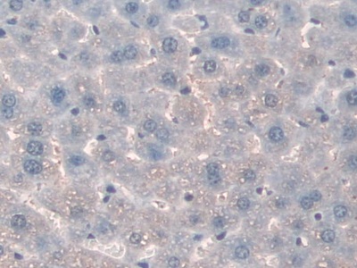 Polyclonal Antibody to Mannose Binding Lectin (MBL)