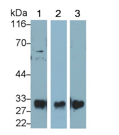 Polyclonal Antibody to Mannose Binding Lectin (MBL)