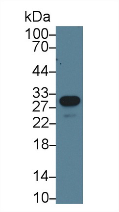 Polyclonal Antibody to Mannose Binding Lectin (MBL)